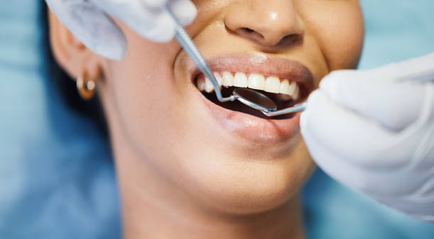 Best Emergency Wisdom Teeth Removal in Eastpointe, MI