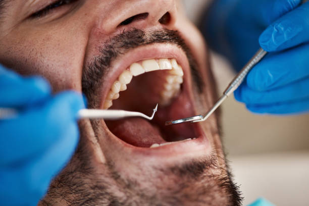 Best Walk-In Emergency Dentist in Eastpointe, MI